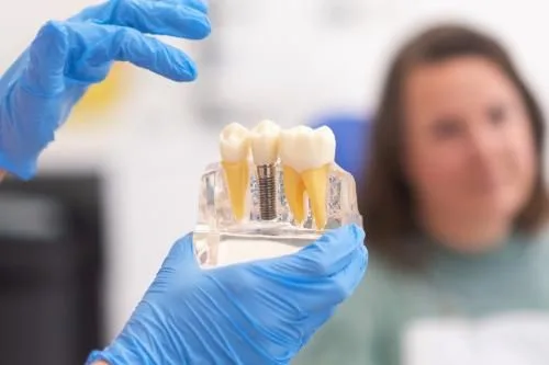 Single dental implant — Plano, TX