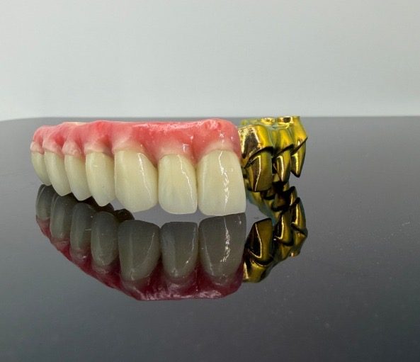 Malo bridge mid-assembly — individual crowns seated on a milled titanium thimble bar, Innate Dental Solutions, Plano TX
