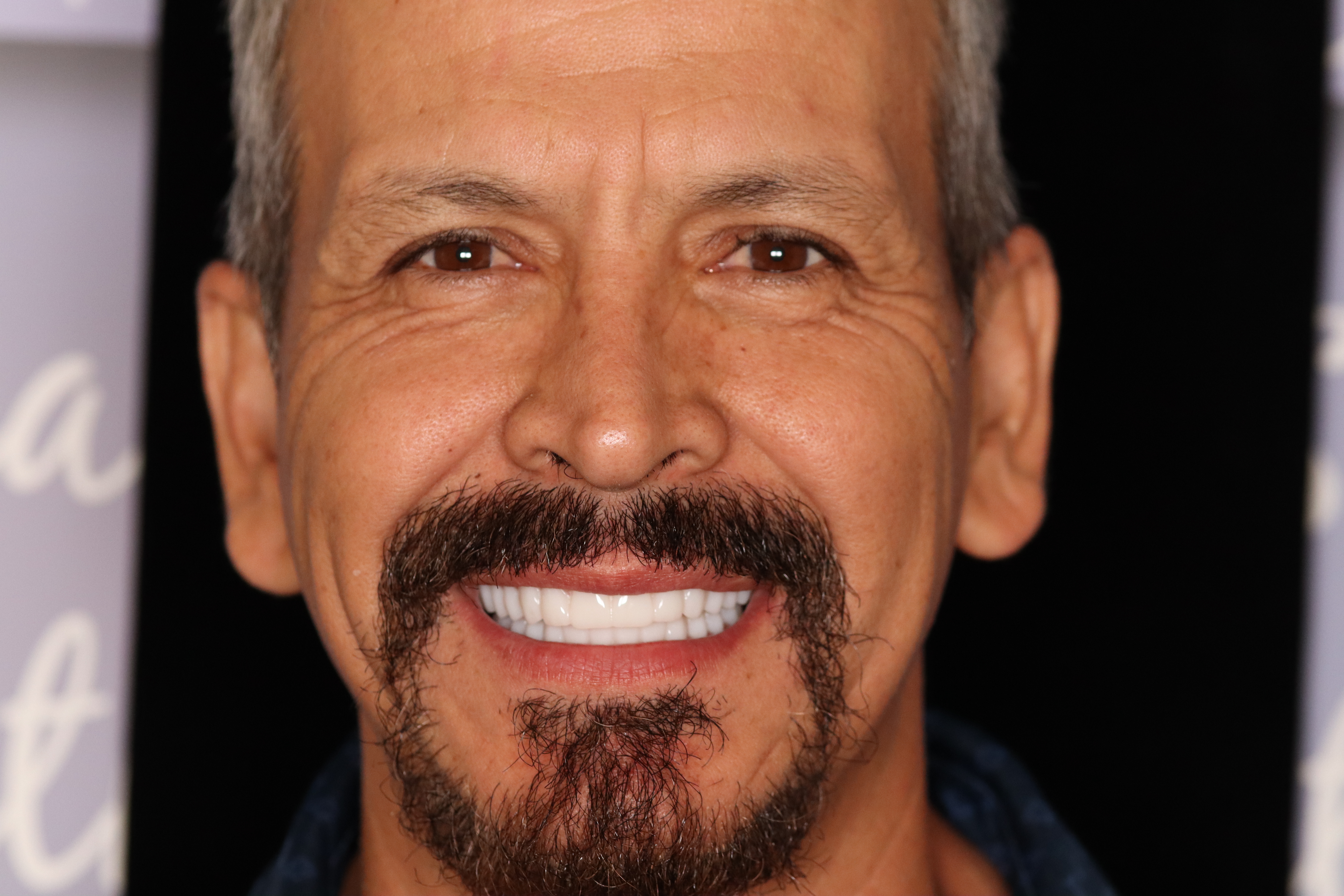 Happy patient smiling after dental implant treatment